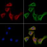 KIF19 Polyclonal Antibody