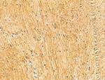KIF19 Antibody in Immunohistochemistry (Paraffin) (IHC (P))