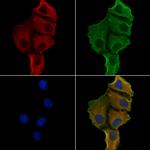 KIF26B Polyclonal Antibody