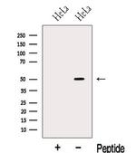 KLF10 Polyclonal Antibody
