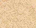 KLH18 Antibody in Immunohistochemistry (Paraffin) (IHC (P))