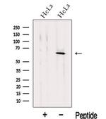 KLH18 Antibody in Western Blot (WB)