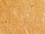 LACTB2 Antibody in Immunohistochemistry (Paraffin) (IHC (P))