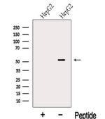 LACTB2 Antibody in Western Blot (WB)