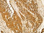 LAS1L Antibody in Immunohistochemistry (Paraffin) (IHC (P))