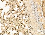 LAS1L Antibody in Immunohistochemistry (Paraffin) (IHC (P))