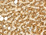 LCA5 Polyclonal Antibody