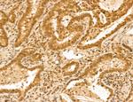 LENG8 Antibody in Immunohistochemistry (Paraffin) (IHC (P))