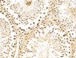 LENG8 Antibody in Immunohistochemistry (Paraffin) (IHC (P))