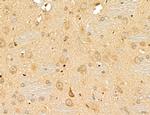 LETM2 Antibody in Immunohistochemistry (Paraffin) (IHC (P))