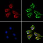 LOH12CR1 Polyclonal Antibody