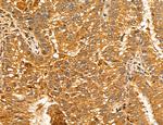LOH12CR1 Antibody in Immunohistochemistry (Paraffin) (IHC (P))