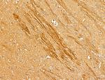 LOH12CR1 Antibody in Immunohistochemistry (Paraffin) (IHC (P))
