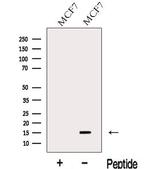 LSM4 Polyclonal Antibody