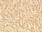 MAP1S Antibody in Immunohistochemistry (Paraffin) (IHC (P))