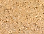 MAP1S Antibody in Immunohistochemistry (Paraffin) (IHC (P))