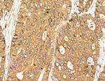 MAP1S Antibody in Immunohistochemistry (Paraffin) (IHC (P))