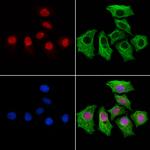MED10 Antibody in Immunocytochemistry (ICC/IF)