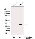 METTL6 Antibody in Western Blot (WB)