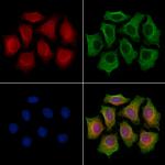 MIPEP Polyclonal Antibody