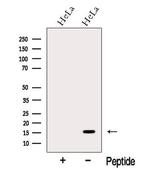 MMS2 Polyclonal Antibody