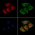 KIAA0391 Polyclonal Antibody