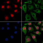 MYEOV2 Polyclonal Antibody