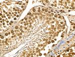 MYEOV2 Antibody in Immunohistochemistry (Paraffin) (IHC (P))