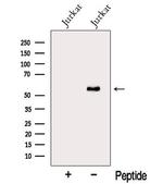 MYEOV2 Antibody in Western Blot (WB)