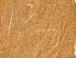 MYOF Polyclonal Antibody
