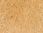 MYOM1 Antibody in Immunohistochemistry (Paraffin) (IHC (P))