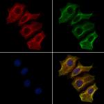 Myotilin Antibody in Immunocytochemistry (ICC/IF)