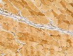 Myotilin Antibody in Immunohistochemistry (Paraffin) (IHC (P))