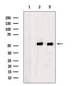 Myotilin Antibody in Western Blot (WB)