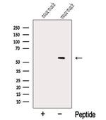 Myotilin Antibody in Western Blot (WB)