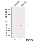 MYOZ1 Polyclonal Antibody