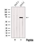 NCOA5 Polyclonal Antibody