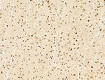 NCOA6 Antibody in Immunohistochemistry (Paraffin) (IHC (P))