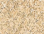 NCOA6 Antibody in Immunohistochemistry (Paraffin) (IHC (P))