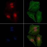 NR1 Polyclonal Antibody