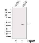 NECAP1 Antibody in Western Blot (WB)