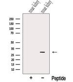 NIT2 Polyclonal Antibody