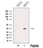 NMRAL1 Polyclonal Antibody