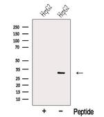 NNMT Polyclonal Antibody