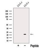 NUDT16 Polyclonal Antibody