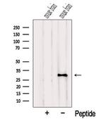 NUS1 Polyclonal Antibody