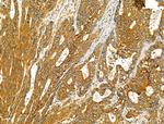 TENM1 Polyclonal Antibody