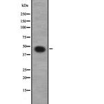 GNA12 Polyclonal Antibody