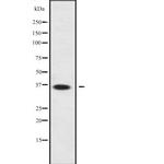 LDHAL6A Polyclonal Antibody