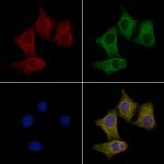 UCP4 Polyclonal Antibody